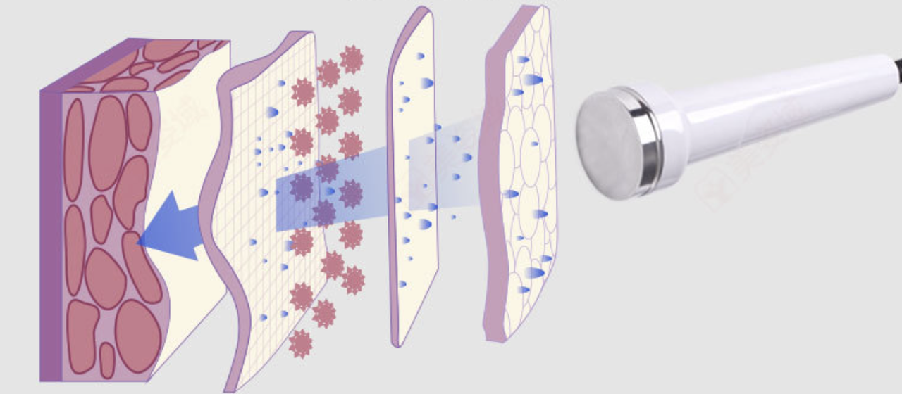 Апарат фонофорезу Н3234 - для обличчя і тіла з електрокоагулятором - Зображення 7