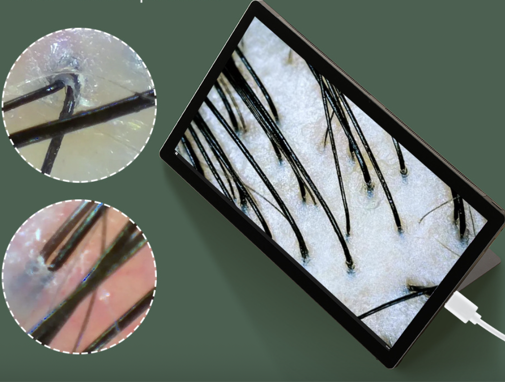 Сканер для шкіри голови (волосяних фолікул) та шкіри обличчя - Зображення 3